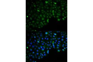 Immunofluorescence analysis of U2OS cells using HK2 antibody. (Hexokinase 2 anticorps  (AA 1-120))