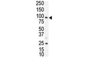 Western blot analysis of AXL antibody and SKBR3 cell lysate.