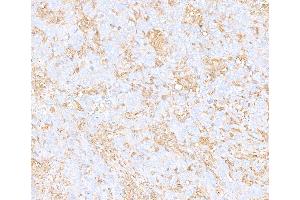 Immunohistochemistry (IHC) image for anti-Cytoskeletal Actin (CIMG_00972) (AA 1-50) antibody (ABIN7449436) (Recombinant Cytoskeletal Actin (CIMG_00972) (AA 1-50) anticorps)