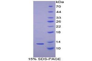 SDS-PAGE analysis of Human Cystatin A Protein. (CSTA Protéine)