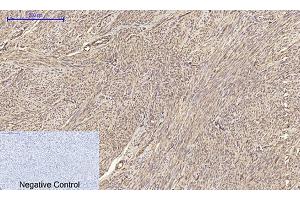 Immunohistochemical analysis of paraffin-embedded human uterus tissue. (Claudin 5 anticorps  (AA 140-220))