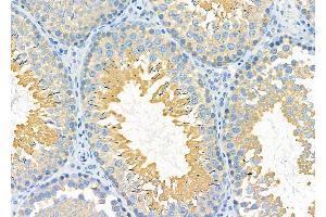 ABIN6259253 and ABIN6275428 at 1/100 staining Rat testis tissue by IHC-P. (PDXDC1 anticorps  (C-Term))