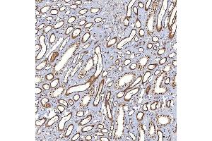 IHC analysis of TRMT61A using anti-TRMT61A antibody (ABIN7599220). (TRMT61A anticorps  (AA 1-289))