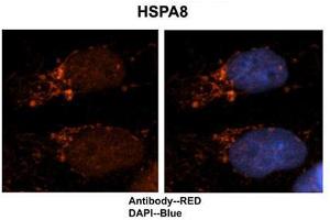 Researcher: Dr. (Hsc70 anticorps  (N-Term))