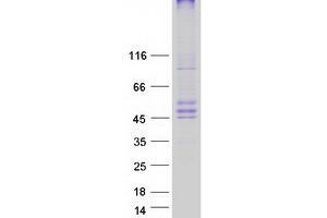 Validation with Western Blot