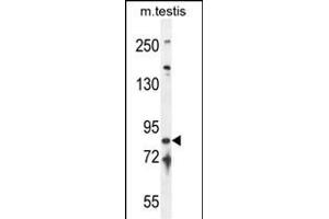 IFT81 anticorps  (C-Term)