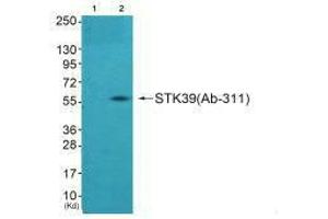 Western blot analysis of extracts from A549 cells using STK39 (Ab-311) antibody,The lane on the left is treated with synthesized peptide. (STK39 anticorps  (Ser311))