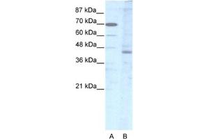Western Blotting (WB) image for anti-LIM Homeobox 2 (LHX2) antibody (ABIN2463841)