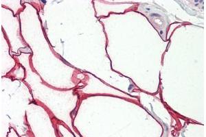 Image no. 2 for anti-Arachidonate 5-Lipoxygenase (ALOX5) (AA 246-295) antibody (ABIN2879109) (ALOX5 anticorps  (AA 246-295))