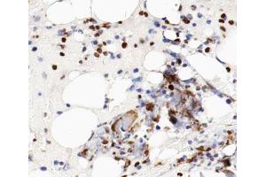 ABIN6266587 at 1/100 staining human bone tissue sections by IHC-P. (MCM5 anticorps  (N-Term))