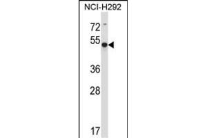 ACTR6 Antibody (C-term) (ABIN657810 and ABIN2846778) western blot analysis in NCI- cell line lysates (35 μg/lane).