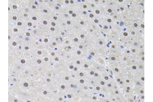 Immunohistochemistry of paraffin-embedded rat liver using HUS1 antibody (ABIN6131776, ABIN6142084, ABIN6142086 and ABIN6218116) at dilution of 1:100 (40x lens).