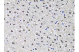 Immunohistochemistry of paraffin-embedded rat liver using HUS1 antibody (ABIN6131776, ABIN6142084, ABIN6142086 and ABIN6218116) at dilution of 1:100 (40x lens). (HUS1 anticorps  (AA 1-280))