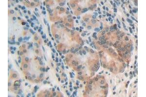 DAB staining on IHC-P; Samples: Human Stomach Tissue