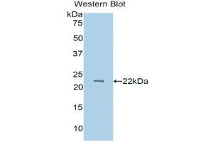 Western Blotting (WB) image for anti-Protein S (PROS) (AA 301-476) antibody (ABIN1175271) (PROS1 anticorps  (AA 301-476))