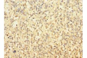 Immunohistochemistry of paraffin-embedded human spleen tissue using ABIN7173647 at dilution of 1:100 (TUBAL3 anticorps  (AA 1-300))