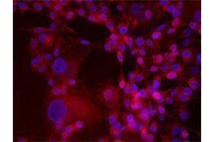 Immunofluorescence (IF) image for anti-Integrin beta 3 (ITGB3) antibody (Alexa Fluor 647) (ABIN2657832)