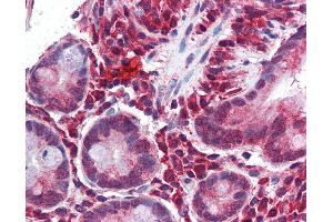 Immunohistochemistry (IHC) image for anti-Matrix Gla Protein (MGP) (Middle Region) antibody (ABIN2784506)