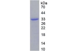 SDS-PAGE analysis of Mouse Integrin beta 2 Protein. (Integrin beta 2 Protein (ITGB2))