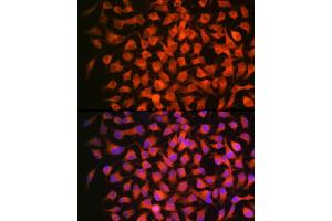 Immunofluorescence analysis of HeLa using RARβ Rabbit mAb (ABIN7269947) at dilution of 1:100 (40x lens). (Retinoic Acid Receptor beta anticorps)