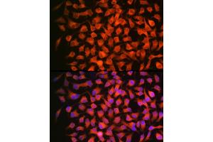 Immunofluorescence analysis of HeLa using RARβ Rabbit mAb (ABIN7269947) at dilution of 1:100 (40x lens).