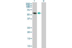 Western Blot analysis of ILDR1 expression in transfected 293T cell line ( H00286676-T02 ) by ILDR1 MaxPab polyclonal antibody. (ILDR1 anticorps  (AA 1-502))