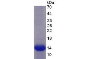 SDS-PAGE analysis of Human Semaphorin 5B Protein.