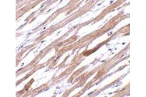 Immunohistochemistry of TIRAP in human heart tissue with this product at 20 μg/ml. (TIRAP anticorps  (Center))