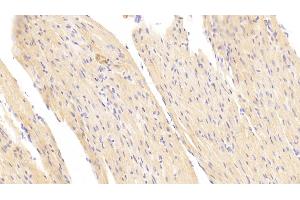 Detection of SDHB in Mouse Heart Tissue using Polyclonal Antibody to Succinate Dehydrogenase Complex Subunit B (SDHB)