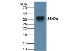 Western blot analysis of Human Liver Tissue. (MSTN anticorps  (AA 266-375))