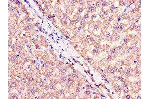 Immunohistochemistry of paraffin-embedded human liver tissue using ABIN7147273 at dilution of 1:100