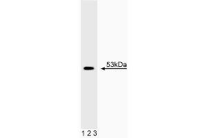 Western blot analysis of p53. (p53 anticorps)