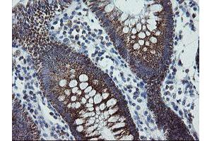 Image no. 4 for anti-Mitochondrial Ribosomal Protein S27 (MRPS27) (AA 151-414) antibody (ABIN1490963)