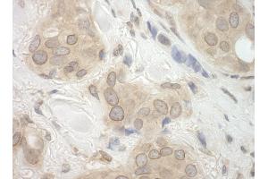anti-Cancer Susceptibility Candidate 3 (CASC3) (AA 653-703) antibody