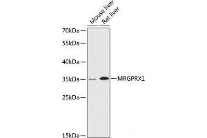 Western blot analysis of extracts of various cell lines using MRGPRX1 Polyclonal Antibody at dilution of 1:3000. (MRGPRX1 anticorps)