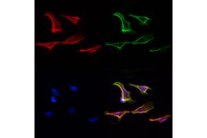 ABIN6265225 and ABIN6277101 staining Hela cells by IF/ICC. (SORD anticorps  (Internal Region))