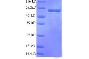 Fatty Acid Binding Protein 9, Testis (FABP9) (AA 25-554), (partial) protein (His tag)