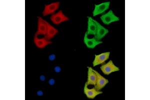 ABIN7096626 and ABIN7100690 staining HepG2 cells by IF/ICC.