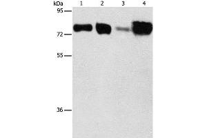 Western Blot analysis of Hepg2 and hela cell, Human fetal kidney and liver tissue using ACSL4 Polyclonal Antibody at dilution of 1:650 (ACSL4 anticorps)