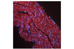 IGF1R antibody used at a concentration of 2-10 ug/ml to detect mouse skeletal muscle (red). (IGF1R anticorps  (Middle Region))