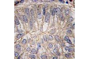 Image no. 3 for anti-P-Cadherin (CDH3) (C-Term) antibody (ABIN357039)