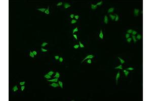 Immunofluorescence staining of HepG2 cells with ABIN7161520 at 1:100, counter-stained with DAPI. (NFKBIA anticorps  (AA 27-317))
