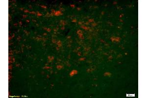 Formalin-fixed and paraffin-embedded rat brain labeled with Anti-Ninein/GSK3B interacting protein Polyclonal Antibody, Unconjugated (ABIN872552) 1:200, overnight at 4°C, The secondary antibody was Goat Anti-Rabbit IgG, Cy3 conjugated used at 1:200 dilution for 40 minutes at 37°C. (GSKIP anticorps  (AA 133-230))