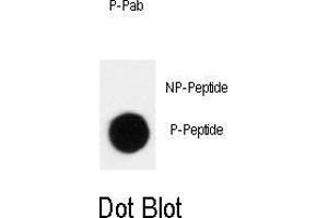 Image no. 1 for anti-Cyclin-Dependent Kinase Inhibitor 1B (p27, Kip1) (CDKN1B) (pThr198) antibody (ABIN358459)