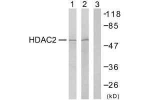 Western blot analysis of extracts from HeLa cells (Lane 1) and 293 cells (Lane 2 and 3), using HDAC2 (Ab-394) antibody (E021140). (HDAC2 anticorps)