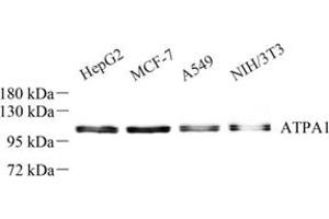 Western blot analysis of Sodium Potassium (ABIN7073154) at dilution of 1: 500 (ATPase (Na/K) anticorps)
