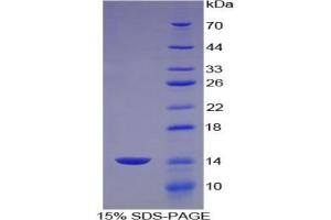 SDS-PAGE analysis of Mouse Aggrecan Protein. (Aggrecan Protein (ACAN))