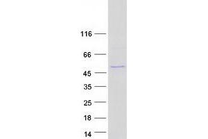 Validation with Western Blot
