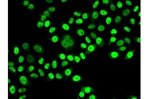 Immunofluorescence analysis of HeLa cells using NUDC antibody.
