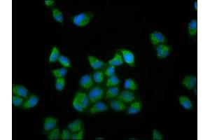 Immunofluorescence staining of Hela cells with ABIN7166026 at 1:133, counter-stained with DAPI. (RUFY3 anticorps  (AA 243-352))